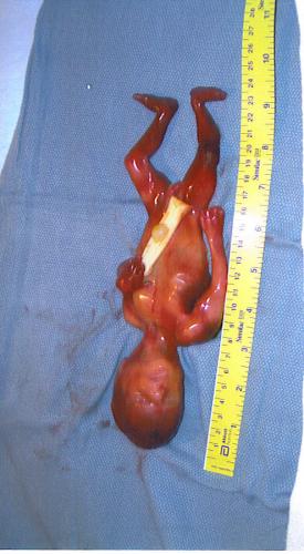 06-16-2007 12X36X31PM